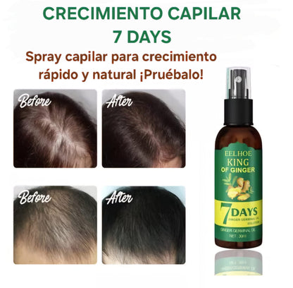 Crecimiento Capilar 7 Days | OFERTA 2X1.